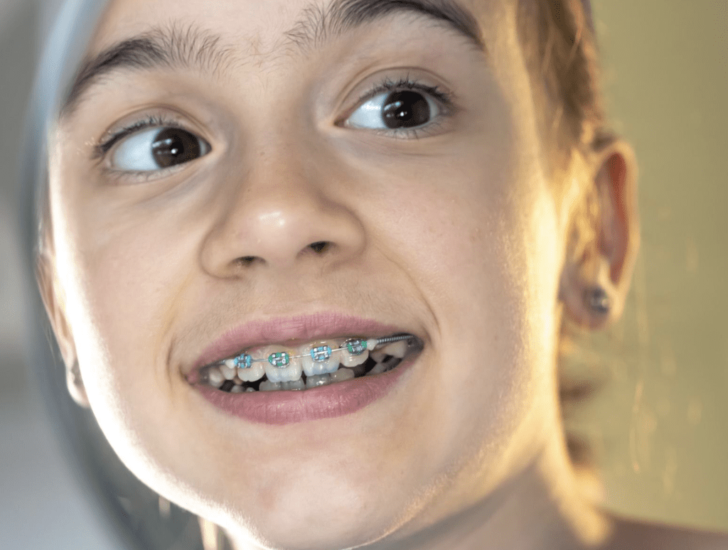 Signs that Your Child May Need Braces